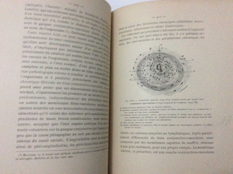 Raro exemplar. LETULLE, Maurice (1853-1929): L'Inflammation. Études anatomo-pathologiques. Rubricado pelo médico António de Padua