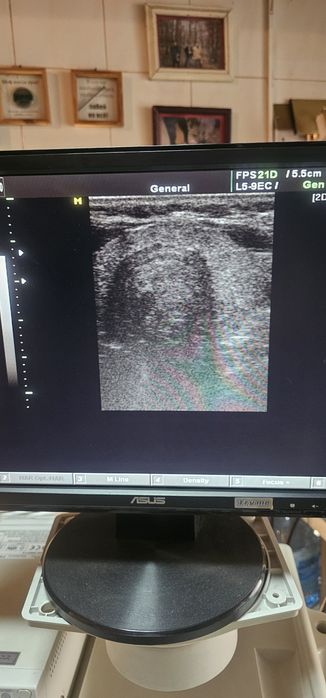 УЗД апарат SONOACE SA-8000 Livе