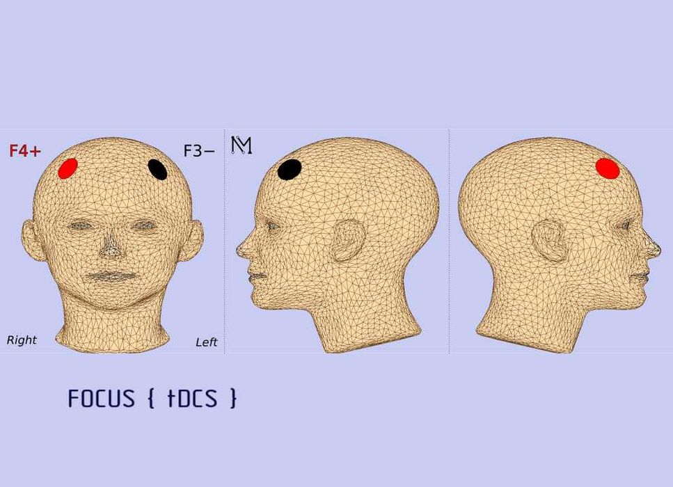 Электростимулятор «NEUROMYST PRO» tdcs тдкс tacs микрополяризация