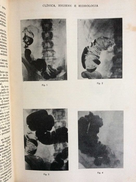 Clínica, higiene e hidrologia ( 4 volumes )