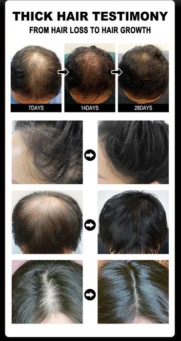 Сыворотка JAYSUING для быстрого роста волос, против выпаде. волос 60мл