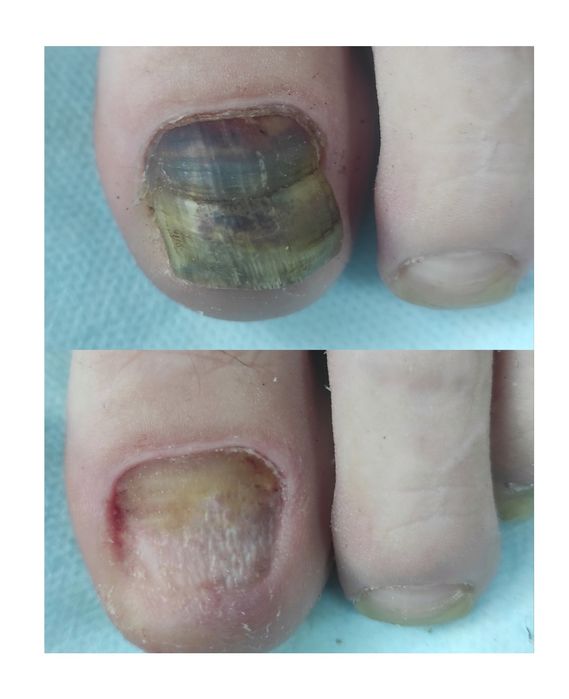 Подолог. Послуги подолога, медичний педикюр,  естетичний педикюр