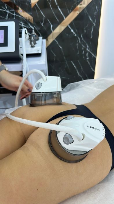 Салон лазерної епіляції та косметології. Працюючий бізнес