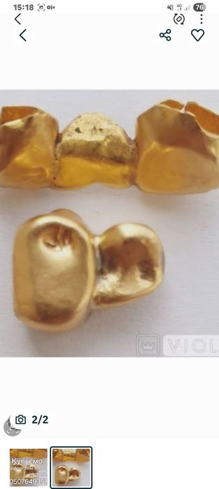 Коронки зубные из драгметал.,