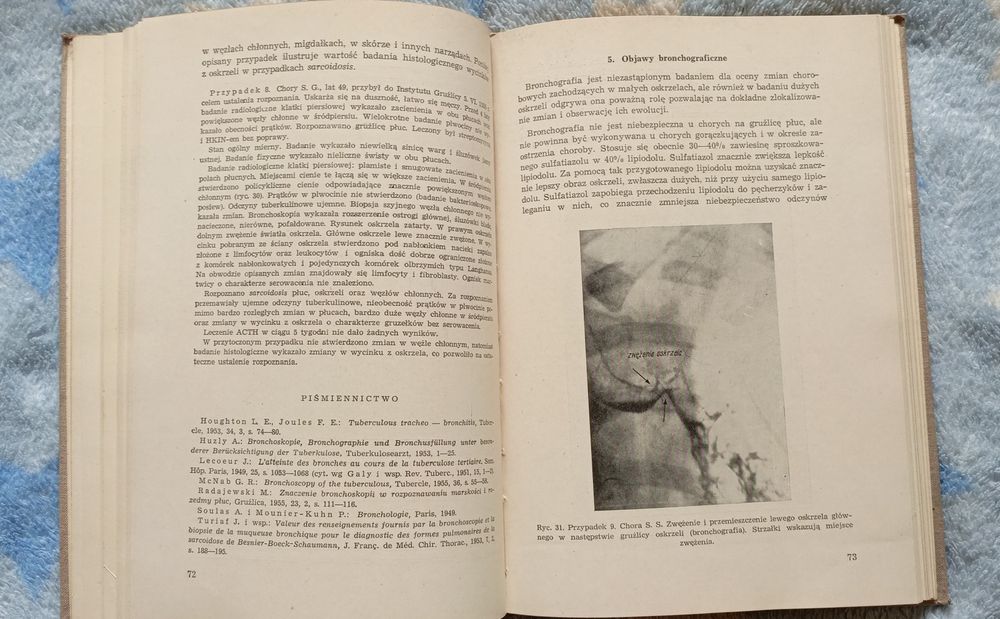 Gruźlica oskrzeli Jaroszewicz i Krakówka 1956r