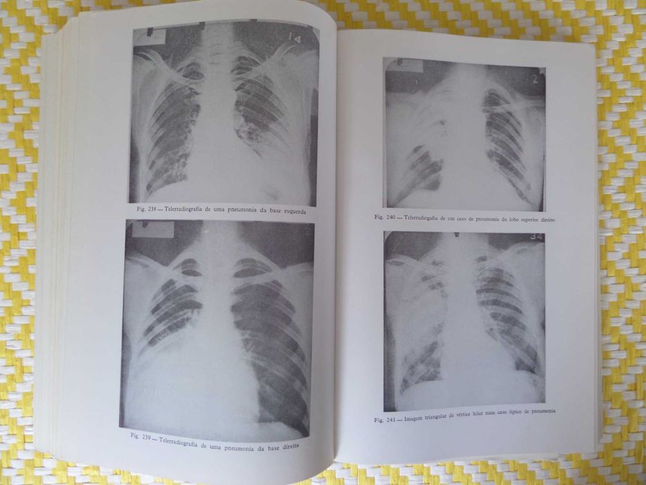 Propedêutica Médica
II Vol . Pneumologia