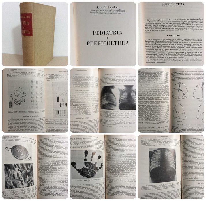 Pediatría Y Puericultura. Por Juan P. Garraham, 1966