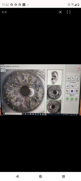 HUNTER 4025 Biorezonans Skaner i Terapia !