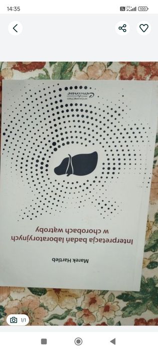 Interpretacja badań laboratoryjnych w chorobach wątroby