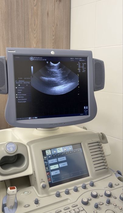 УЗД апарат GE Healthcare LOGIQ 9 / 4 датчики / робочий