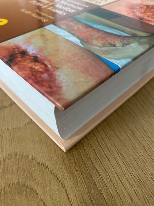 Livro Úlceras de Perna