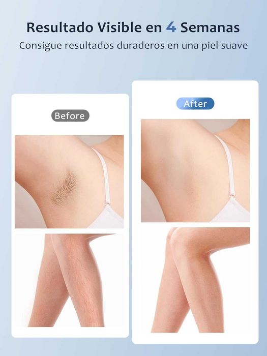 Máquina de Depilação a Laser IPL 3 em 1, portátil