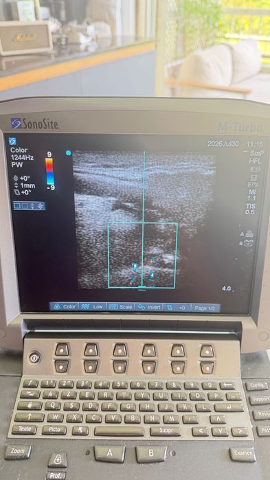 узд sonosite turbo M