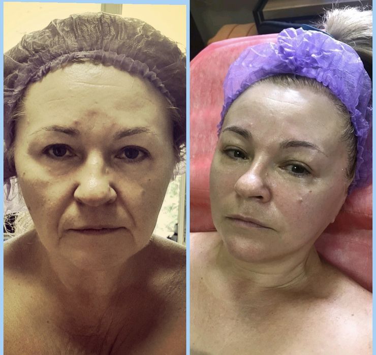 КУРСИ Масаж обличчя    Індивідуально (3 техніки в одному масажi) ОФЛАЙН/ОНЛАЙН