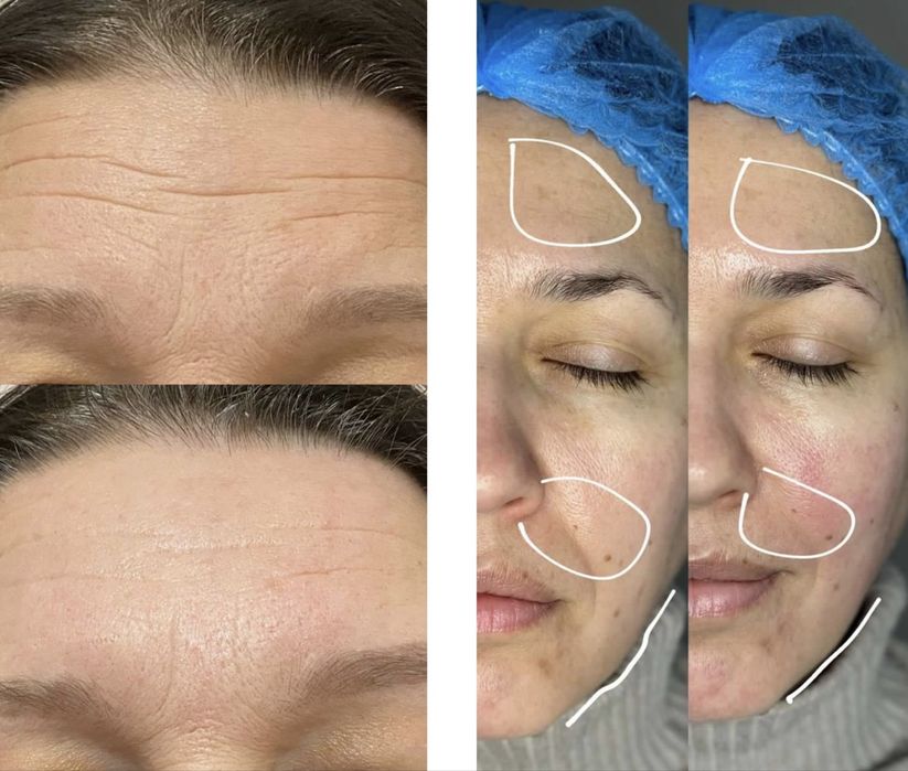 Plamine Clione Fit портативний косметологічний апарат