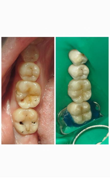 СтоматологОдесса , якісно ,безболісно, всі види стоматологічних послуг