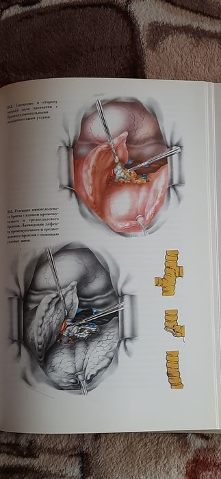 Атлас онкологічних операцій