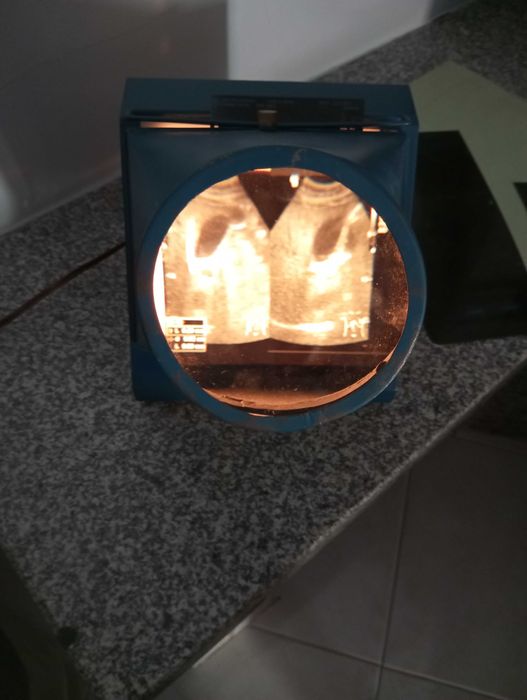 Negatoscópio radiografias