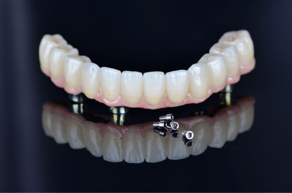 Зуботехнічна лабораторія пропонує співпрацю. Зубний технік.