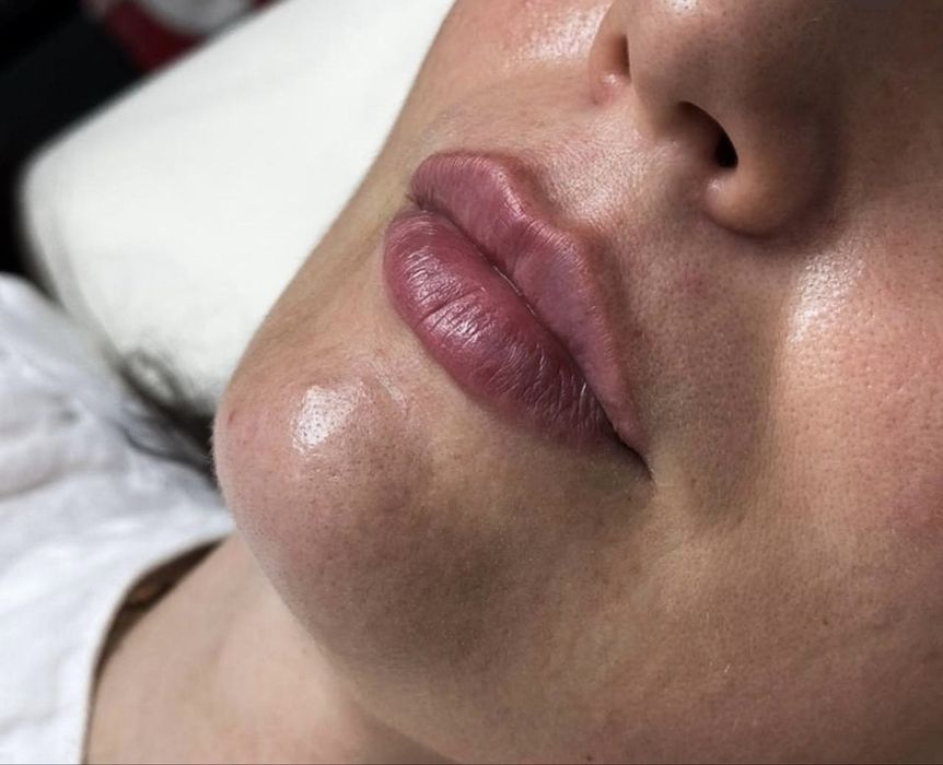 Лікар-Косметолог-Дерматолог Коммунарівський р-н,піски,4-й південний