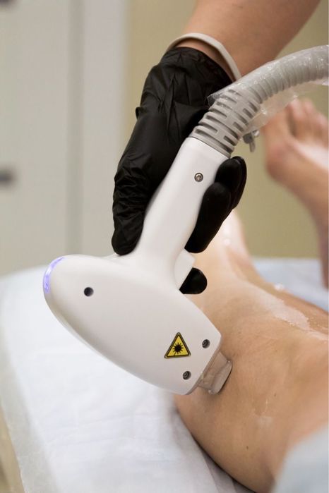 Лазерна епіляція, воскова депіляція, Геров Днепра, Оболонь