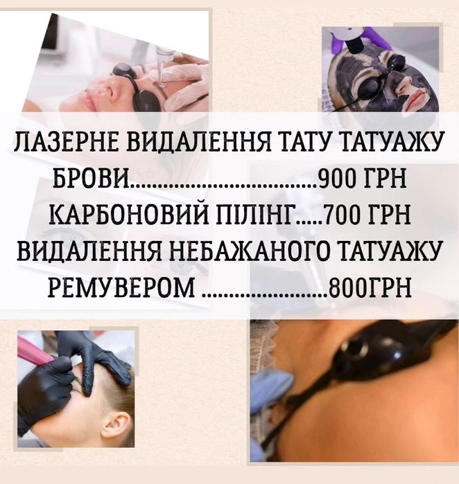 Видалення татуажу - тату РЕМУВЕР  - ЛАЗЕР