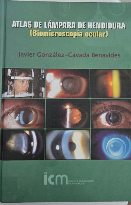 Atlas de Lámpara de Hendidura