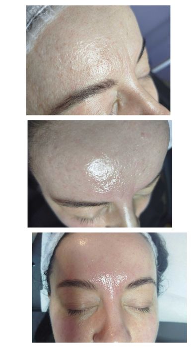 kosmetologia estetycznej – edukacja i pielęgnacja w Pabianicach!