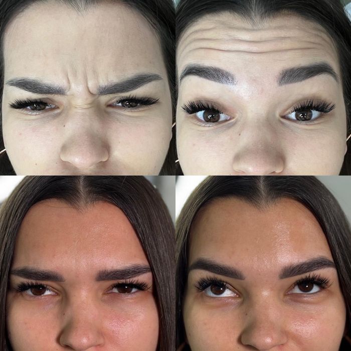 Лікар-Косметолог-Дерматолог Коммунарівський р-н,піски,4-й південний