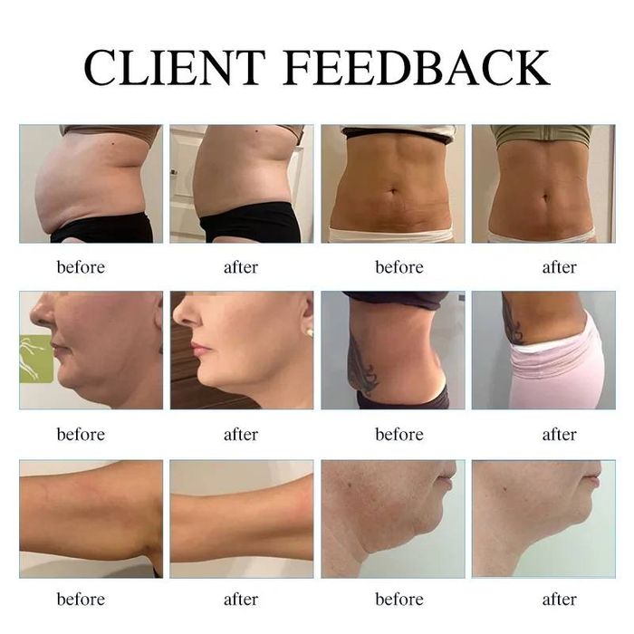 Масажер KIM 8 Slimming System 40K 9 в 1.