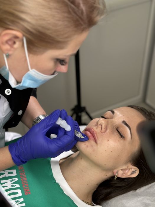 Косметолог. Контурна пластика губ, мезотерапія, біоре-ція, ліполітик.