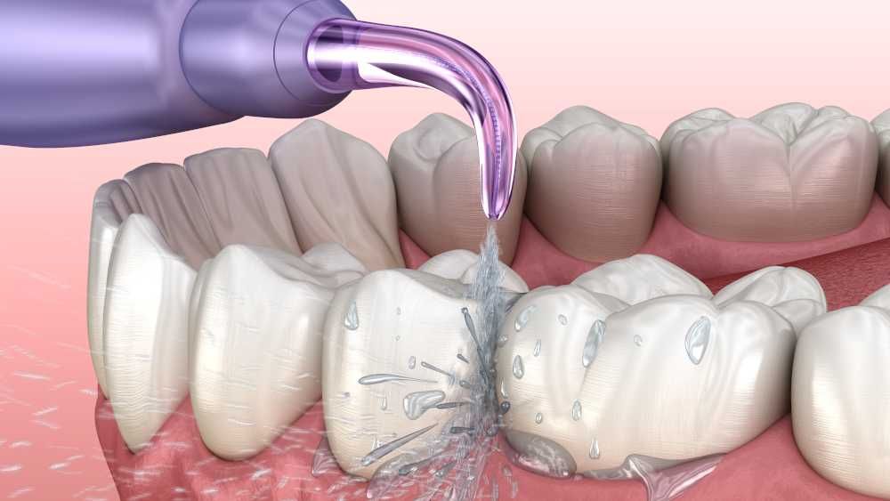 Irygator do zębów Oral Irrigator C12-PUR | NOWY