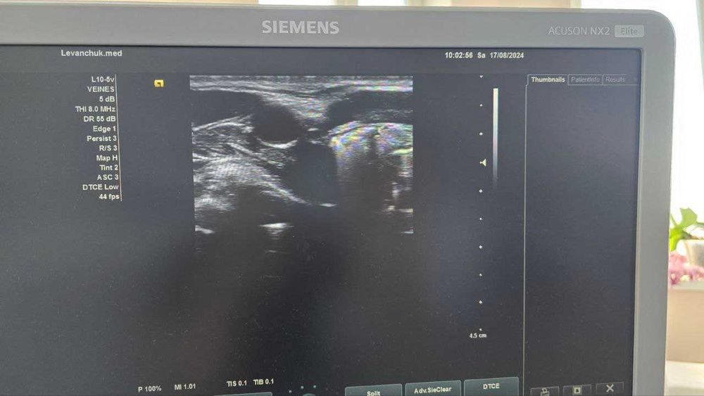 Лінійний датчик УЗД Siemens L10-5V