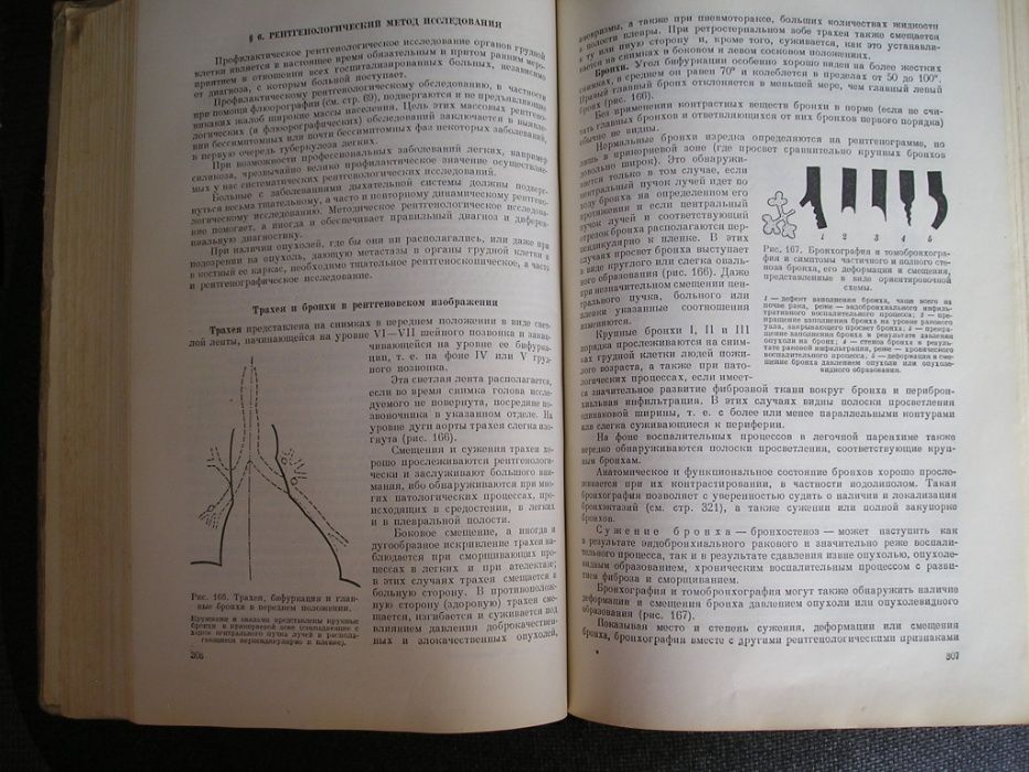 Черноруцкий Диагностика внутренних болезней 1953 г. (медицина)