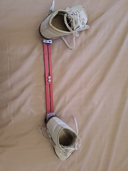 Брейси. Ортопедичне взуття для лікування клишоногості