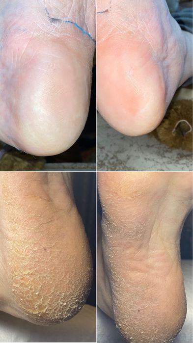 Подолог, маникюр, педикюр Каменское