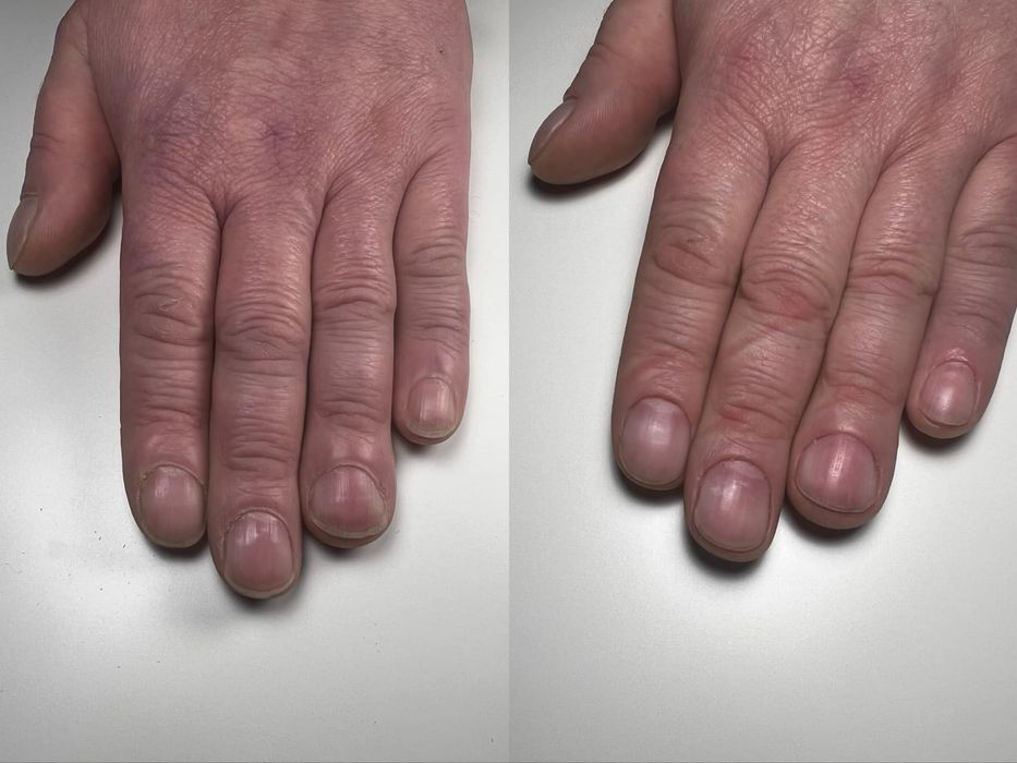 Zapraszam na Paznokcie