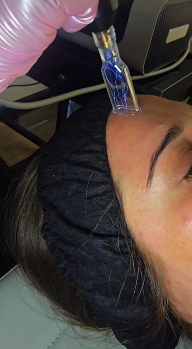 Plazma Argonowa salon kosmetyczny trycholog