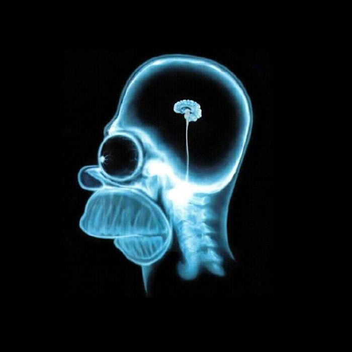 Chumbo em Rolo para isolamento radiologico hospitalar