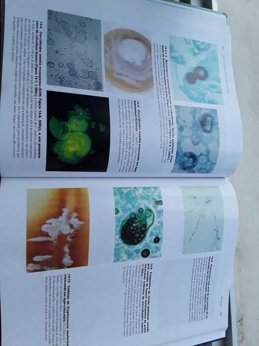 Vendo Atlas de Microbiologia Clínica. Novo.