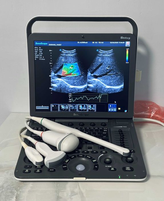 УЗИ\УЗД апарат SonoScape S8-Exp/Соноскейп/4 датчики/Еластографія/3D-4D