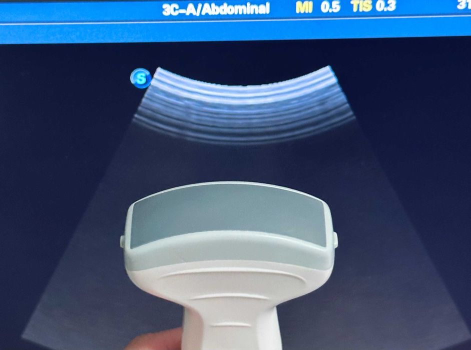 УЗИ\УЗД апарат SonoScape S8-Exp/Соноскейп/4 датчики/Еластографія/3D-4D