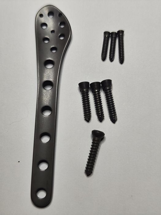 Титанова пластина для остеосинтезу малогомілкової кістки