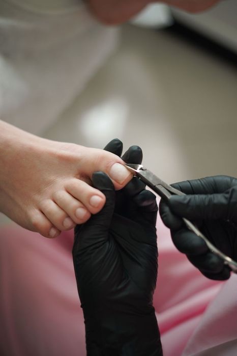 Медичний педикюр будь-якої складності