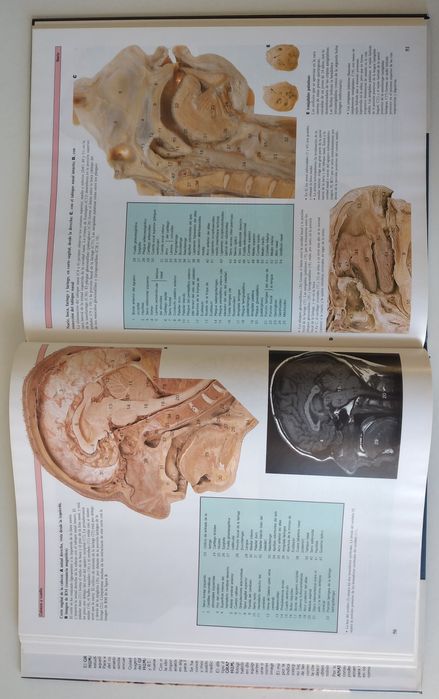 Atlas Anatomia Humana - 2 livros novos em Espanhol