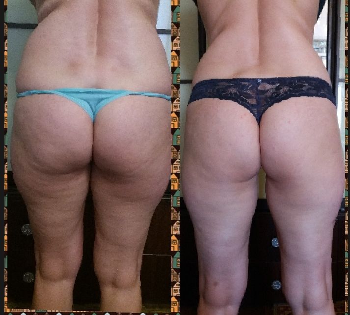 Косметолог естетист. Метро КПІ