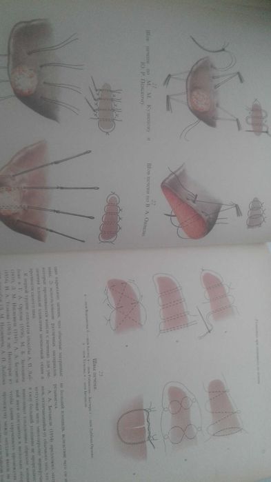 Атлас операций на печени 1975 год