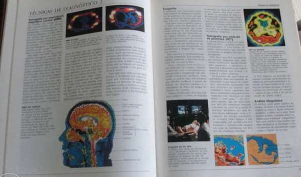 Enciclopédia de Medicina / ] Selecções do Reader's Digest - 2 volumes.
