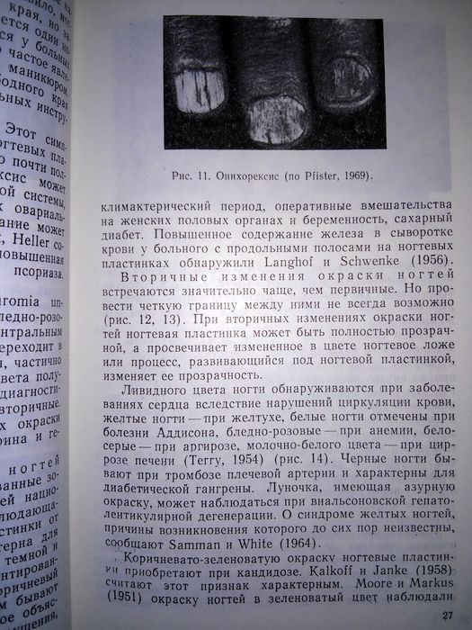 Шеклаков Болезни ногтей