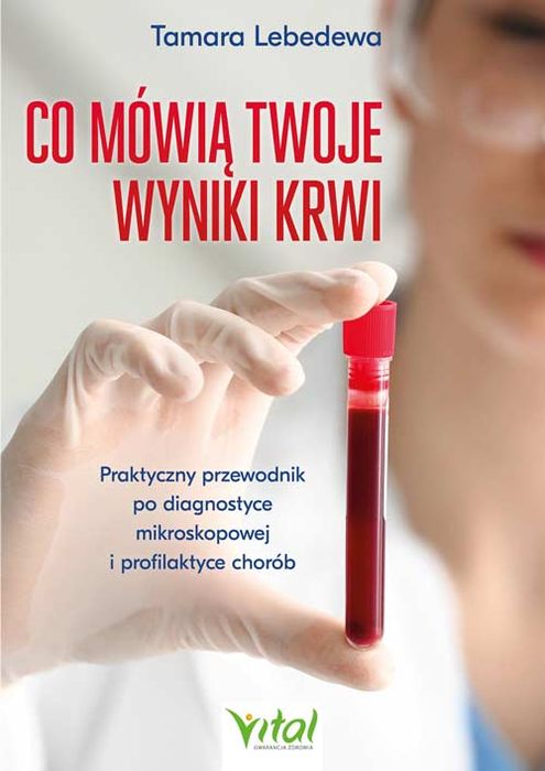 Co Mówią Twoje Wyniki Krwi. Praktyczny Przewodnik Po Diagnostyce Mikroskopowej I Profilaktyce Chorób. Nowy Produkt